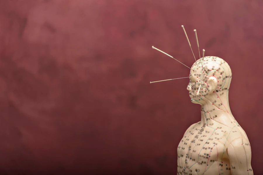 acupuncture clinic in Libertyville