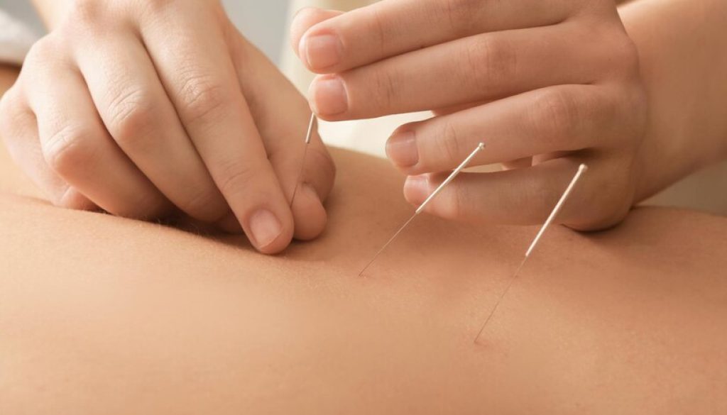 young-man-getting-acupuncture-treatment-closeup_495423-14343